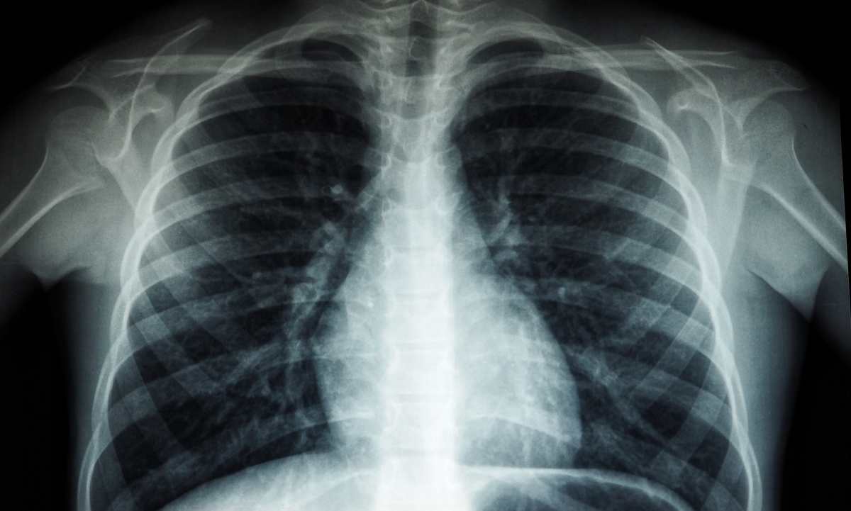 Radiografia 