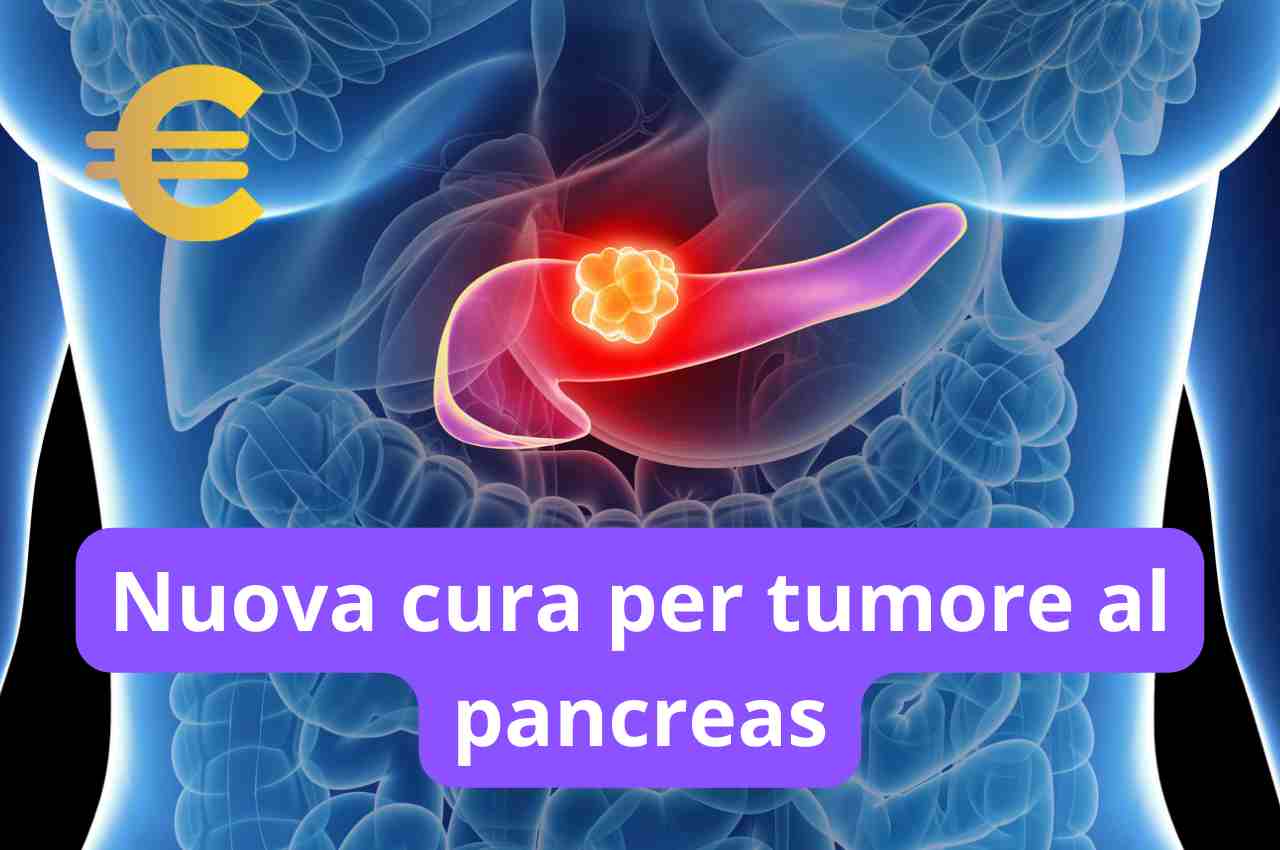 Nuova cura per tumore al pancreas