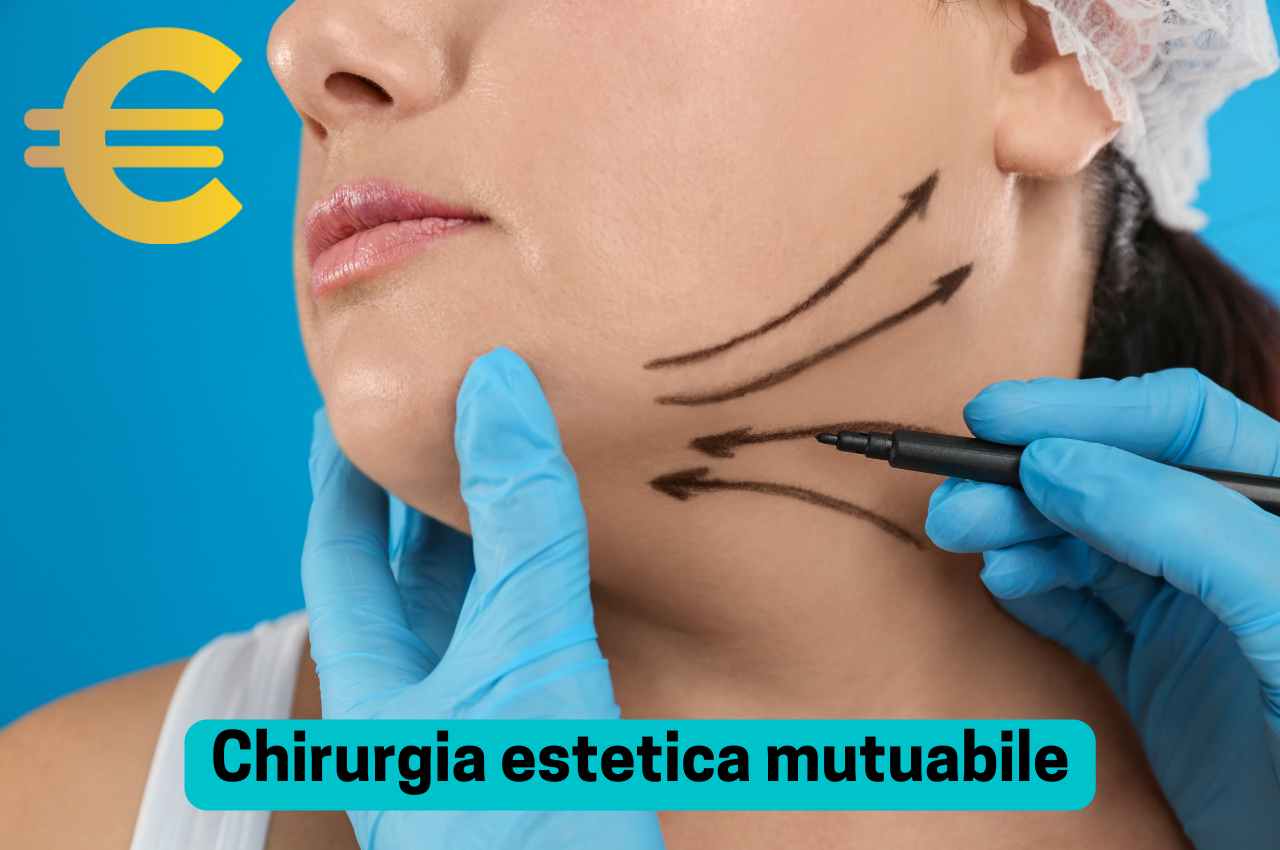 Chirurgia estetica mutuabile